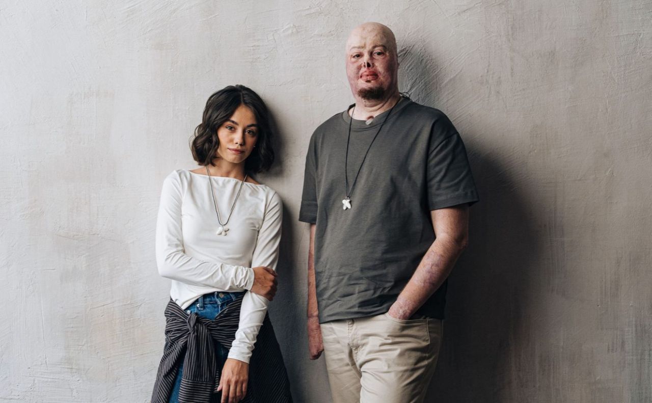 Пташка від проєкту «Ми однієї крові» підтримає українців з опіками