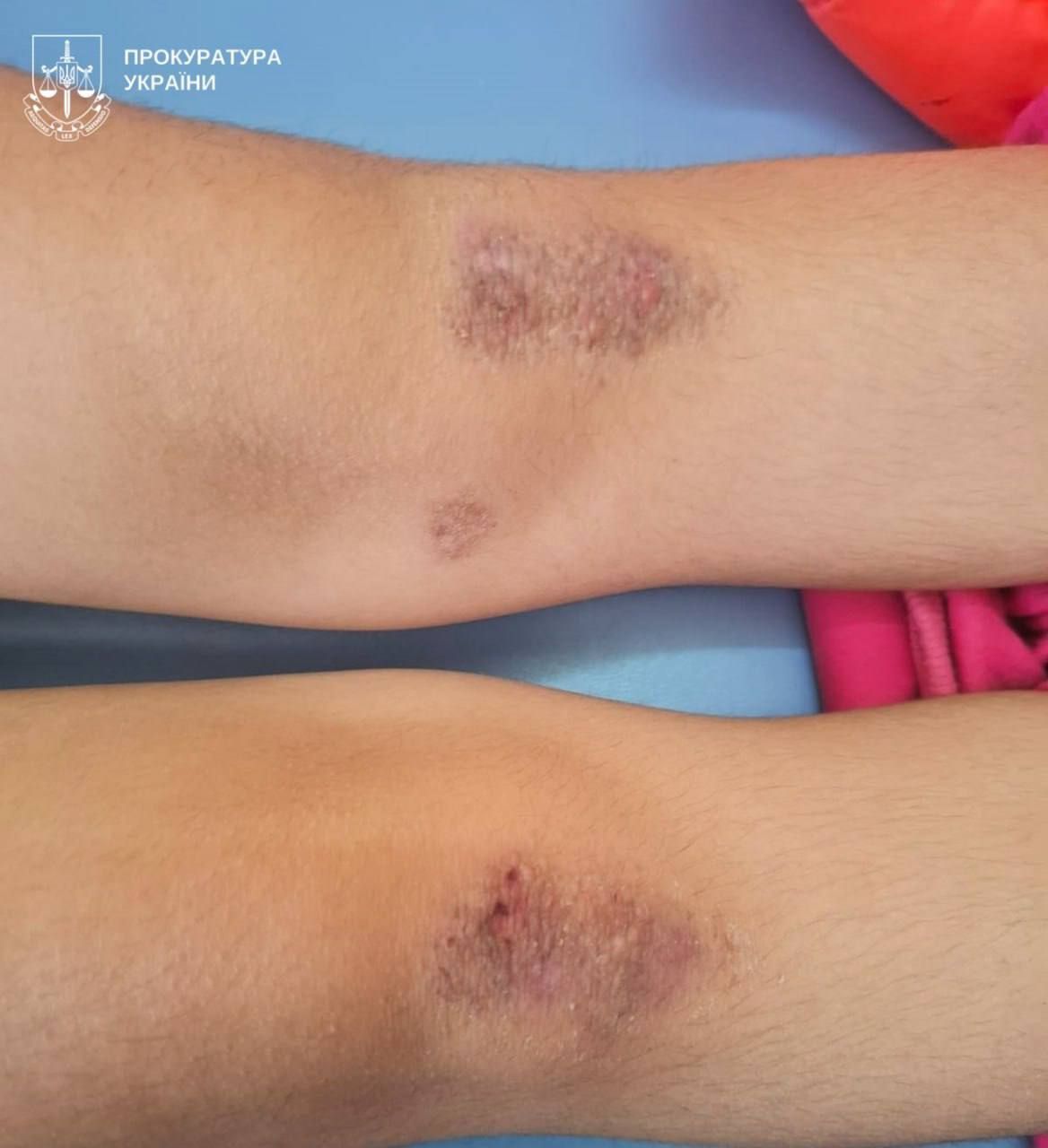 Дві доби на колінах без їжі і без туалету: жінка «карала» рідних сестер за солодощі