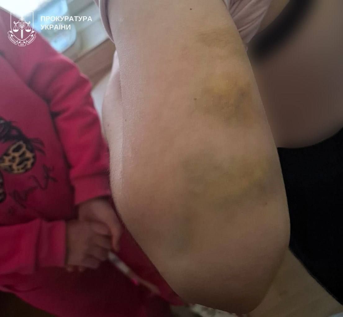 Дві доби на колінах без їжі і без туалету: жінка «карала» рідних сестер за солодощі