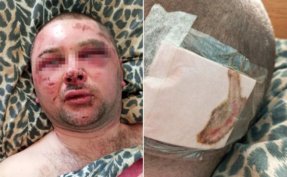 Правоохоронці розслідують побиття людини в Покровському