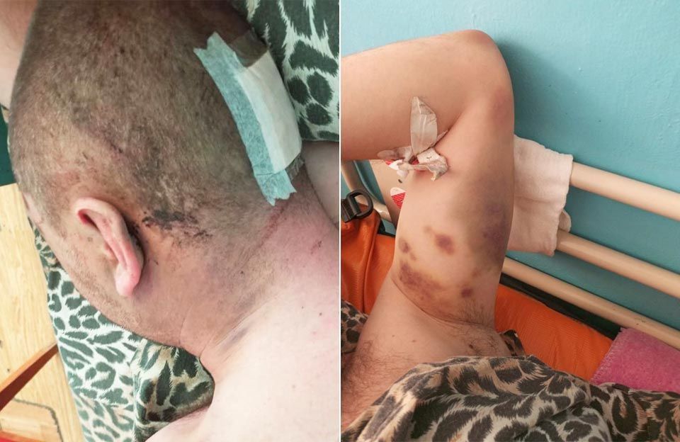 Правоохоронці розслідують побиття людини в Покровському